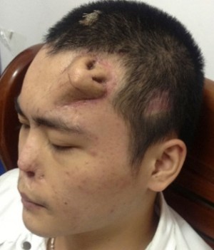 foreheadddd.jpg Foreheadddd