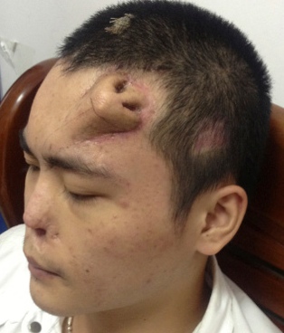 foreheadddd.jpg Foreheadddd