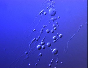 Sarfus.LipidVesicles