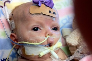 pertussis-baby-one
