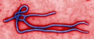 Ebola_virus_virion