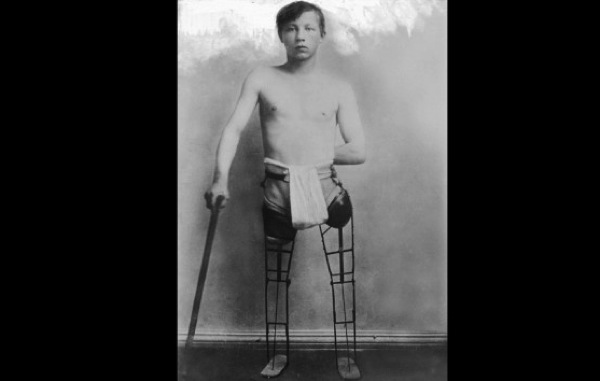 140609140730-02-wwi-prosthesis-0609-restricted-horizontal-gallery.jpg 140609140730 02 wwi prosthesis 0609 restricted horizontal gallery