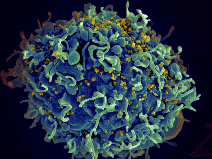 "HIV, the AIDS virus (yellow), infecting a human cell." Seth Pincus, Elizabeth Fischer and Austin Athman, National Institute of Allergy and Infectious Diseases, National Institutes of Health