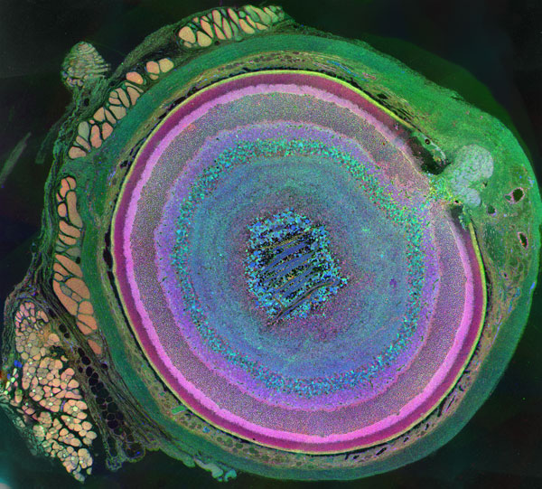 "A mammalian eye has approximately 70 different cell types." Bryan William Jones and Robert E. Marc, University of Utah