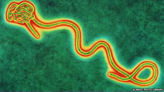 Ebola virus.