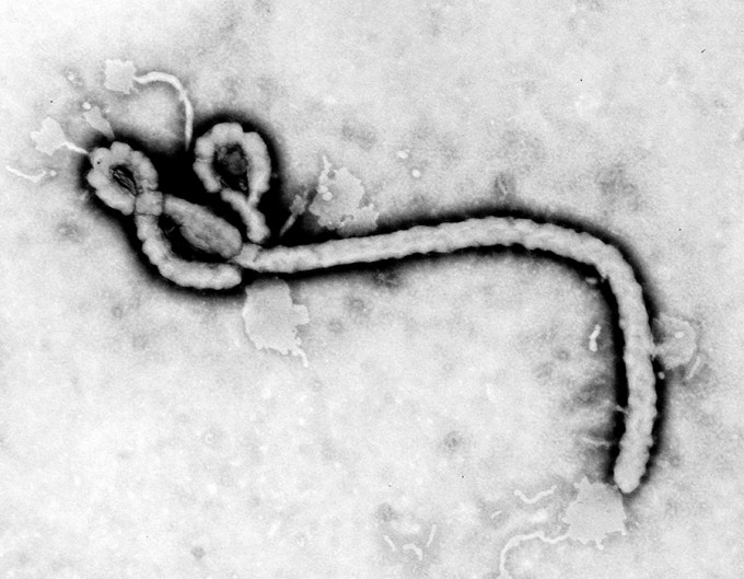The Ebola virus, pictured here, causes disease that currently leads to death in 25 to 90 percent of cases. (Transmission electron micrograph image of Ebola virus, courtesy of the Centers for Disease Control and Prevention.)