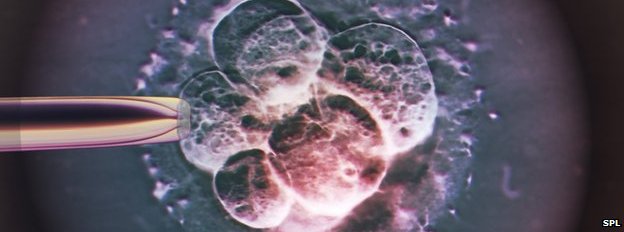 _80766845_c0104967-ivf_embryo,_light_micrograph-spl