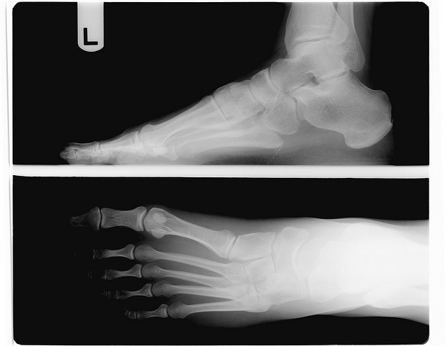 When A Patient Says "no Thanks" To Surgery - Boing Boing