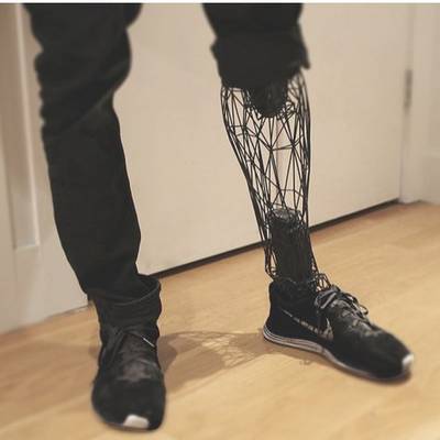 3D printed prosthetic leg - Boing Boing